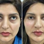 f00c38_092e197e769f4dc5833838ed9f86cdce~mv2