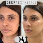 f00c38_56fc93d7b0544b3da7ca6340fd971a35~mv2