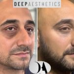 f00c38_61ae63efffda4fe797d0edc6946b8299~mv2