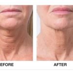 f00c38_a1aec3a7e8a944218993cb5ecca1b65d~mv2