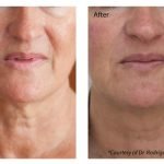 f00c38_d40d80c241cd48e784c2b6e8a1acc6aa~mv2