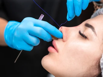 What Is A Non-Surgical Rhinoplasty?