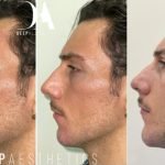 f00c38_11b50c06ea9d4f05ad301014b1f38709~mv2