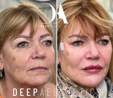 f00c38_38cfd6a6e7bb4ebb8e2f4ff9c4c8f7ea~mv2