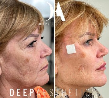 f00c38_3af502d1074b468f9629fdc0a9ba5ec9~mv2