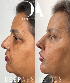 f00c38_40b9699af37642da87ee9ae5b84e61ee~mv2