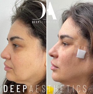 f00c38_42d2555dae134ce4936244437070f5eb~mv2