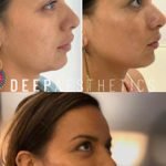 f00c38_4b2ca5a1fdf94eb69dc7cfa52e6a904c~mv2