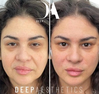 f00c38_57dfdc4ff3054763bb23aac0e8053660~mv2