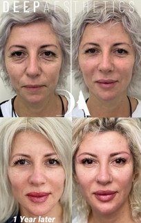 f00c38_5e0a5142750c4a83a97ab46f31b14bbb~mv2