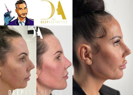 f00c38_5f5df9e868c5485785478c10396a0001~mv2