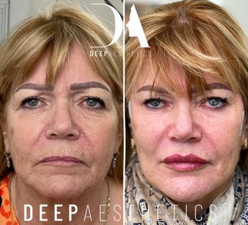 f00c38_7d75eba11a07499497f046dd345a58b5~mv2