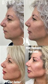 f00c38_96ddf0050ad14f398dc60eb2bbb4bdb9~mv2