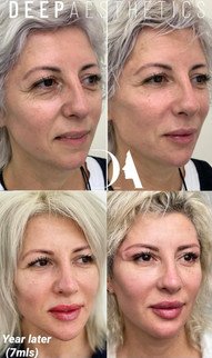 f00c38_a3fa3451d64547978489ddde649a2263~mv2