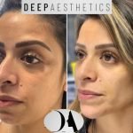 f00c38_a452154cc2e243c28caff9bf3976ae49~mv2