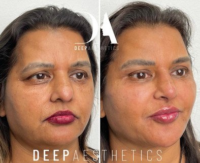 f00c38_a77b45536983453c8fd4d58ef8447ad5~mv2