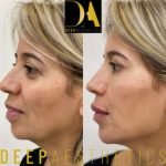 f00c38_b36eca09a18545a7ac516886bc88869d~mv2