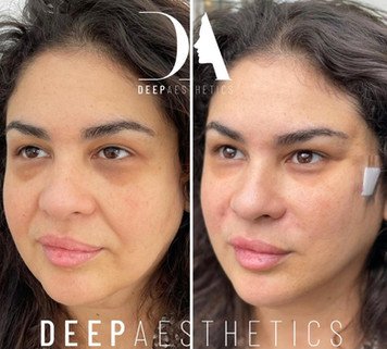 f00c38_d1d35686fa904695adbf5be66d8aad0f~mv2