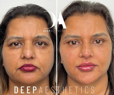 f00c38_e2486fb58a374a4e998329889d82a65b~mv2