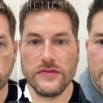 f00c38_e28b6e3dc3804d2197ab8fbfc3e12ef4~mv2