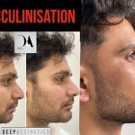 Facetune_01-08-2022-00-19-52