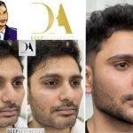 Facetune_01-08-2022-02-46-04