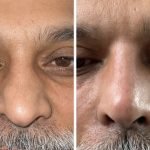 IMG_8112_Facetune_21-04-2022-18-03-58