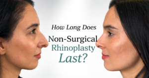 How Long Does Non-Surgical Rhinoplasty Last