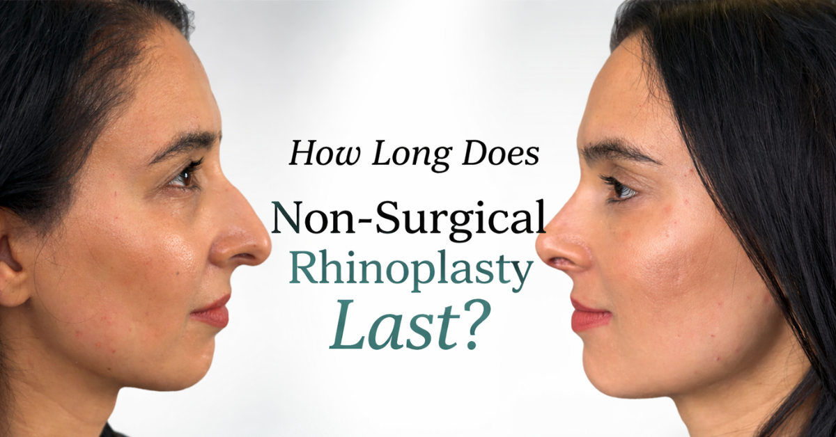 How Long Does Non-Surgical Rhinoplasty Last