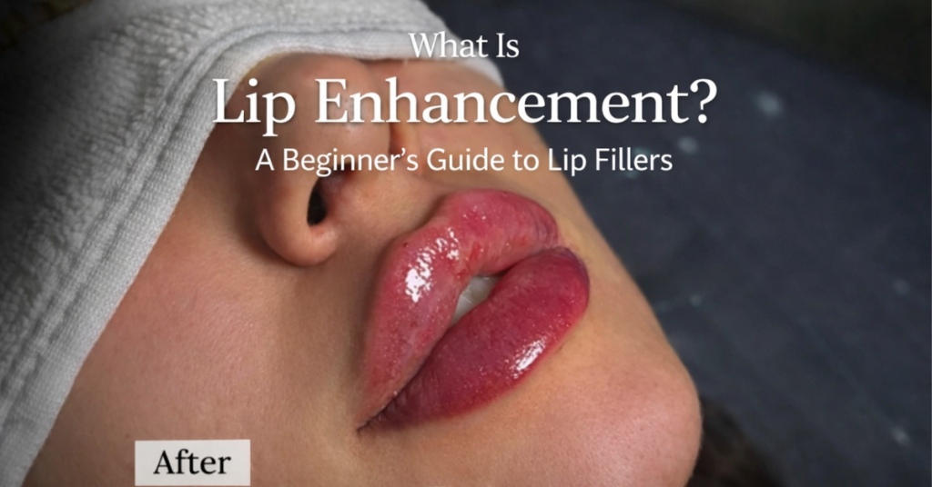 What Is Lip Enhancement