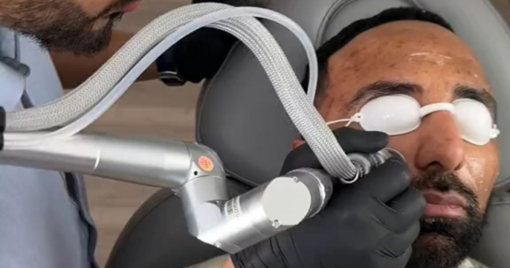 how do i choose the best co2 laser treatment