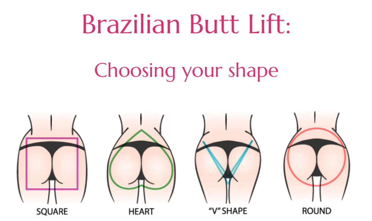 Square, heart, V-shaped and round buttock contour illustrations used during liquid BBL treatment planning