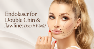 Endolaser for Double Chin & Jawline: Does It Work?