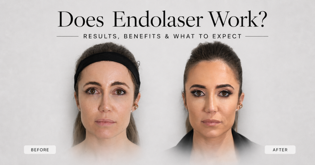 Does Endolaser Work? Results, Benefits & What to Expect