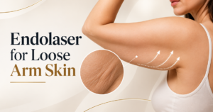 endolaser for loose arm skin